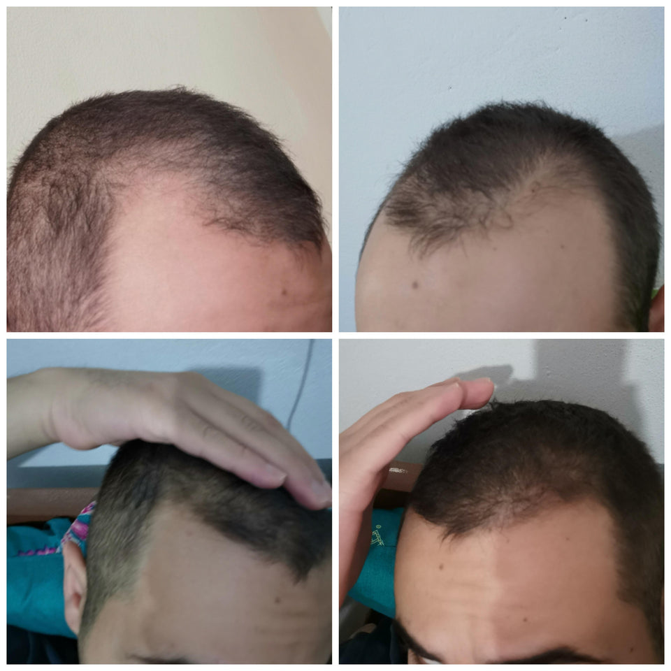 HairUp – Crecimiento real visible